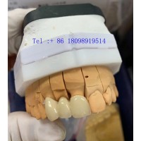 深圳数字化种植牙代工中心 种植体加工厂出口贸易