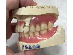 AI数字化种植牙技术研发企业 3D打印种植牙加工厂图2