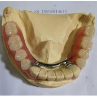 AI数字化种植牙技术研发企业 3D打印种植牙加工厂