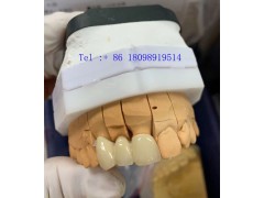 美国FDA认证义齿加工 - 深圳高端假牙种植牙出口厂家图2