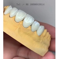 深圳高端义齿加工  义齿出口美国FDA认证