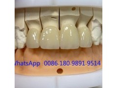 深圳高端义齿加工  义齿出口美国FDA认证图3